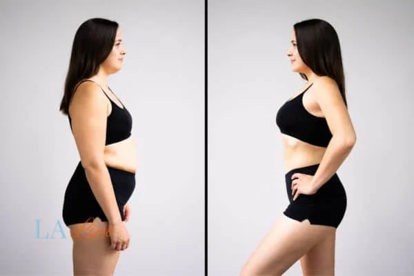 link between body image and mental health Solihull