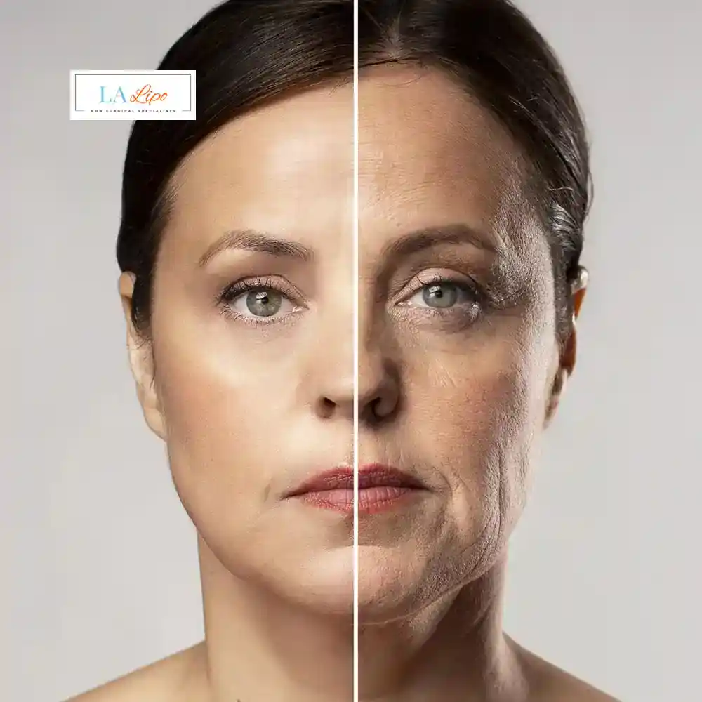 How Can You Tell If Non-Surgical Skin Tightening Is Right for You Solihull?
