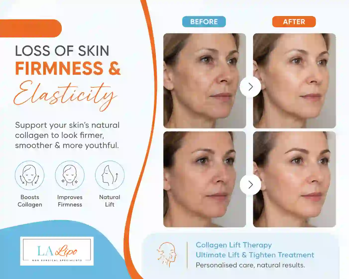 Sign #7: Loss of Skin Firmness and Elasticity Solihull
