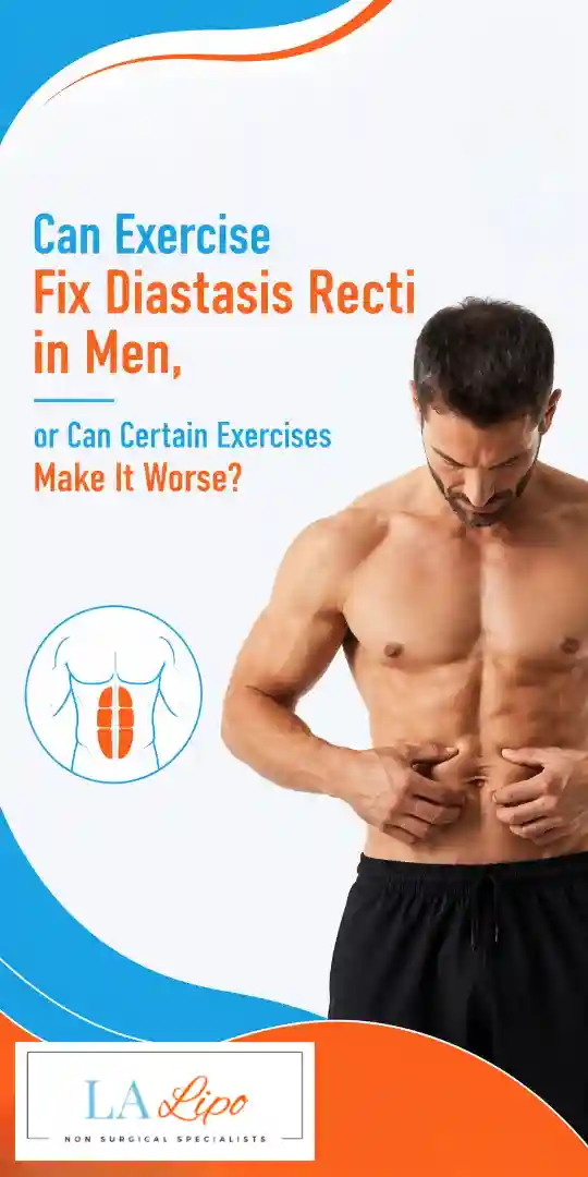 Can Exercise Fix Diastasis Recti in Men, or Can Certain Exercises Make It Worse Solihull?