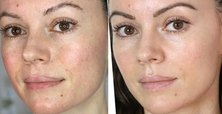 What happens during treatment Solihull