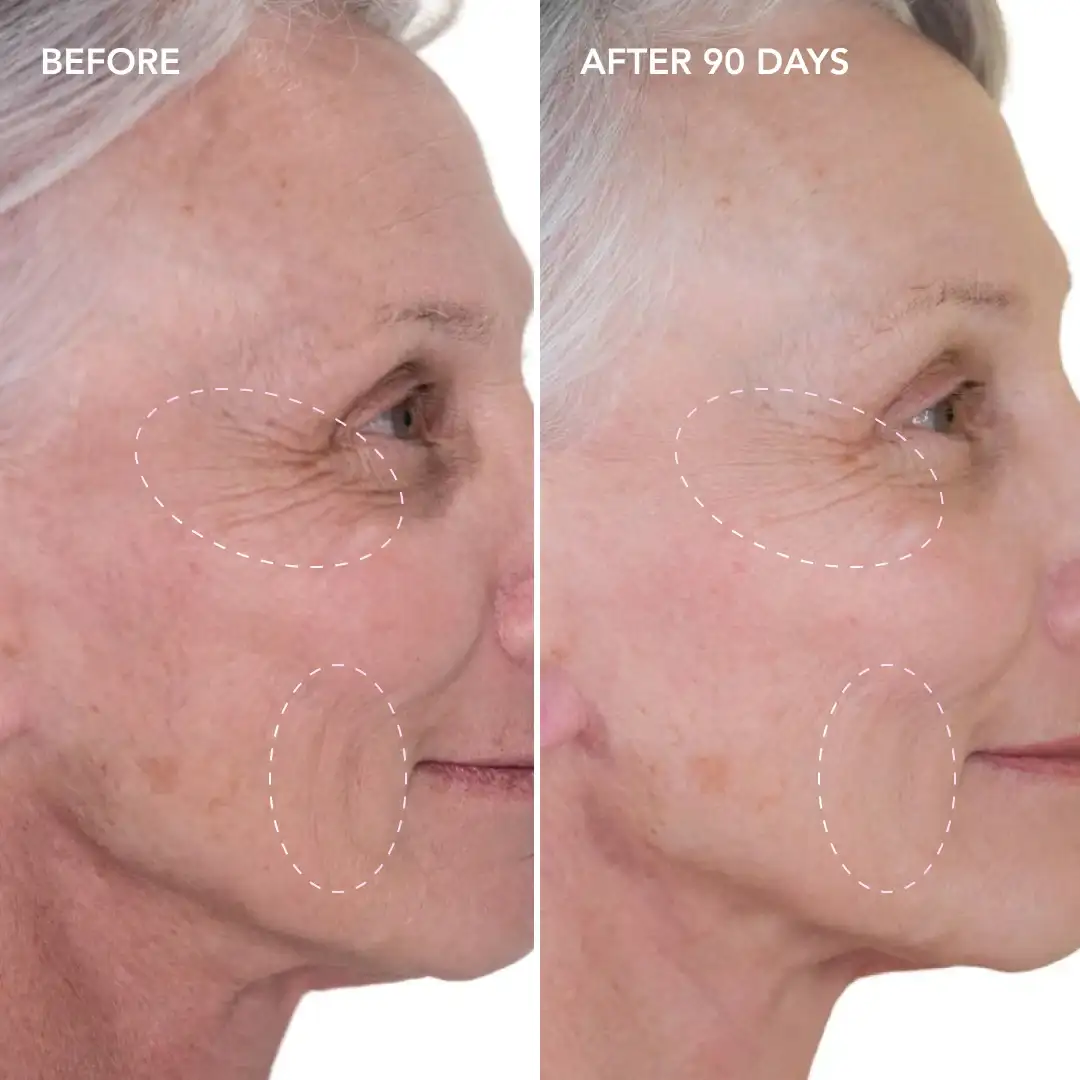 When will you see results Solihull